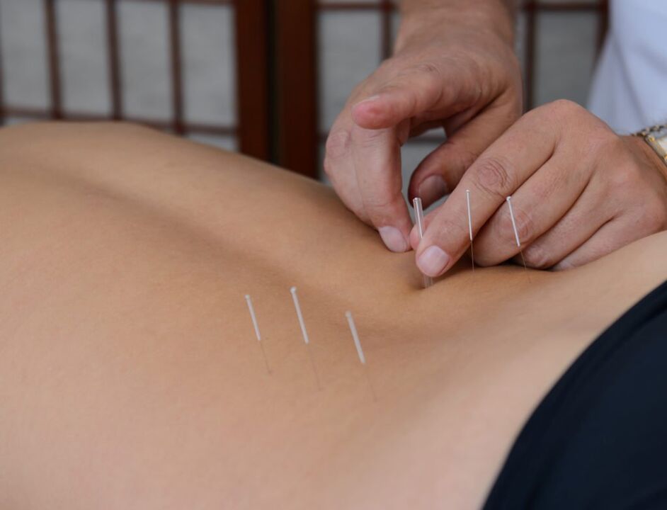 prostatit için akupunktur