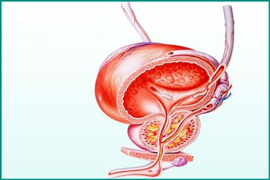 Akut prostatitte prostat iltihabı cinsiyet açısından bir sınırlamadır