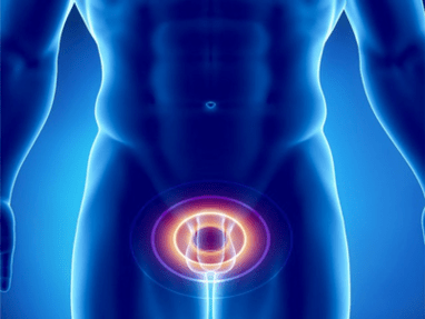 Prostatit – bir erkekte prostat bezinin iltihabı
